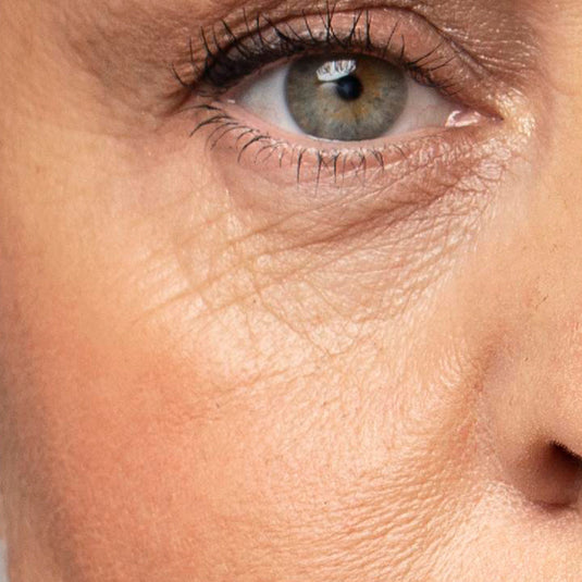 Fine Lines / Wrinkles