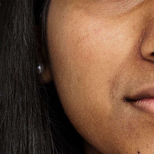 Uneven Tone